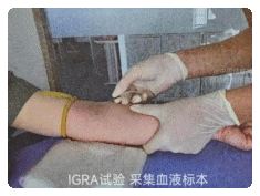 154520bqiui28xued6fq23.png